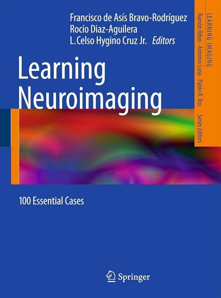 健康・医学 Interventional Neuroradiology Interventional Neuroradiology | Northwestern Medicine
